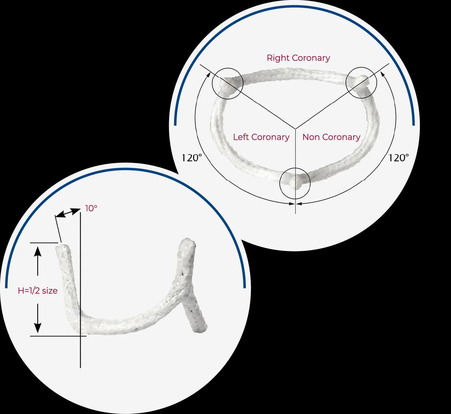 HAART 300 device diagrams: top view showing three commissures at 120 degrees with right, left, and non-coronary cusp sectors; side view showing 10-degree outward post flare and height equal to half the device size