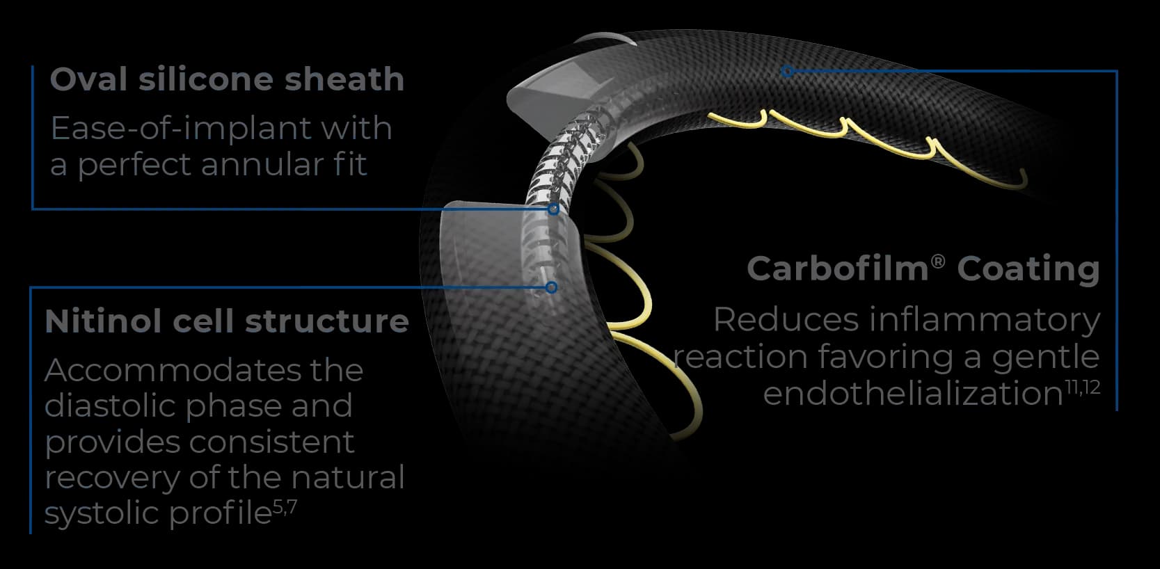 Memo 4D mitral ring showing silicone sheath, internal nitinol structure, and Carbofilm coating for fit, flexibility, and biocompatibility