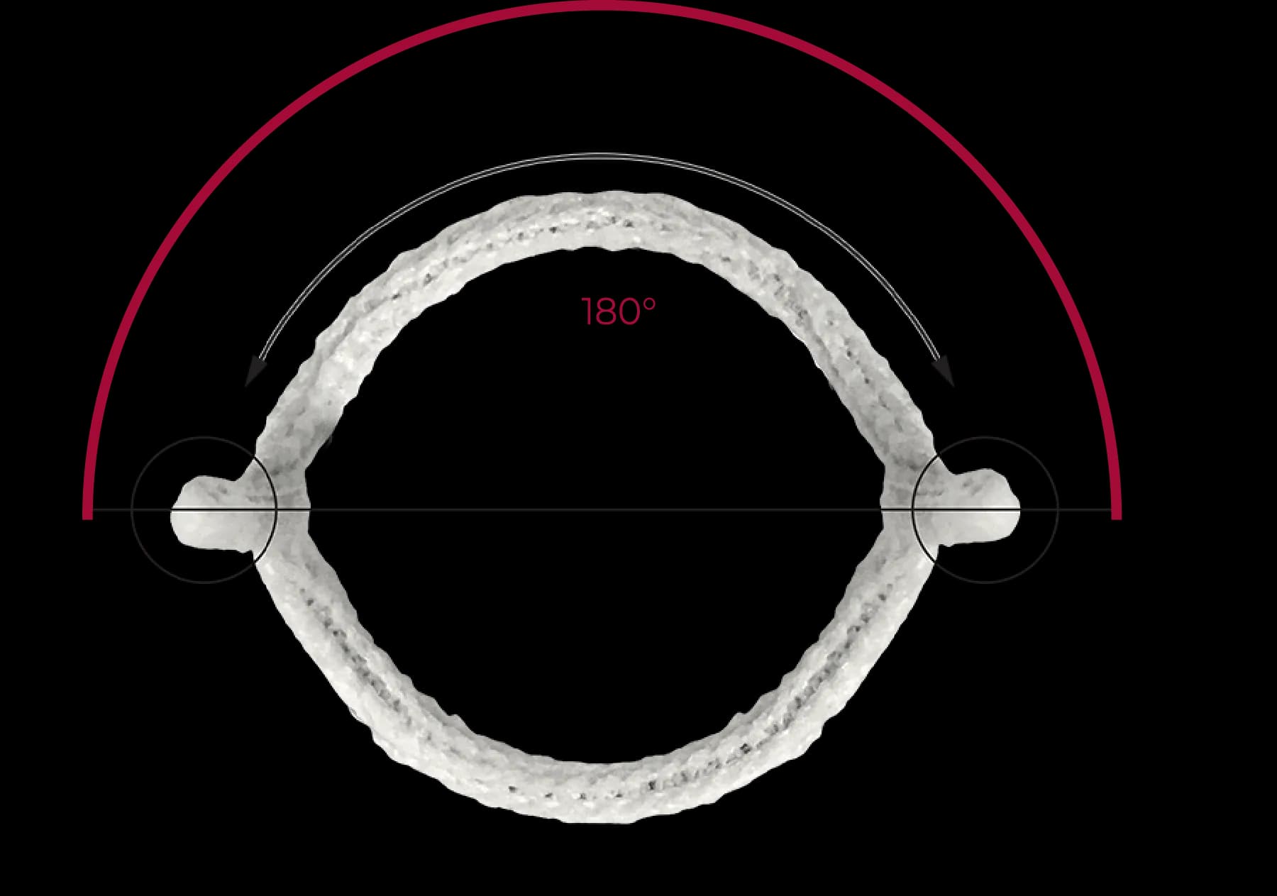 Top-down 3D render of HAART 200 annuloplasty ring showing commissures positioned at exactly 180 degrees apart for symmetric bicuspid aortic valve repair